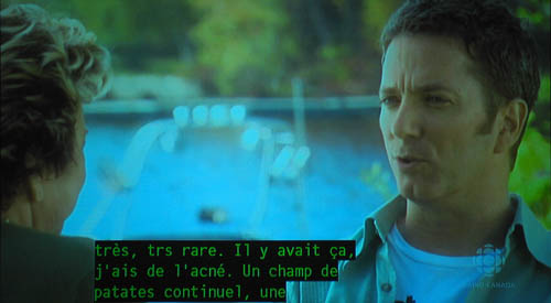 Screenshot shows interview segment with French caption: très trs rare. Il y avait ç, j'ais de l'acné