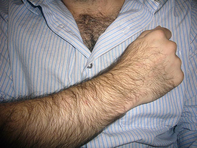 Hirsute arm held across rumpled, somewhat unbuttoned shirt